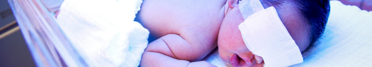 Icterícia no recém-nascido: causas e tratamento